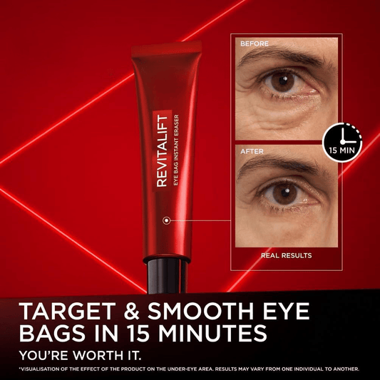 ✨HOT SALE 49% OFF🌿Eye Bag Instant Eraser, Tightens, Firms, & Blurs Wrinkles