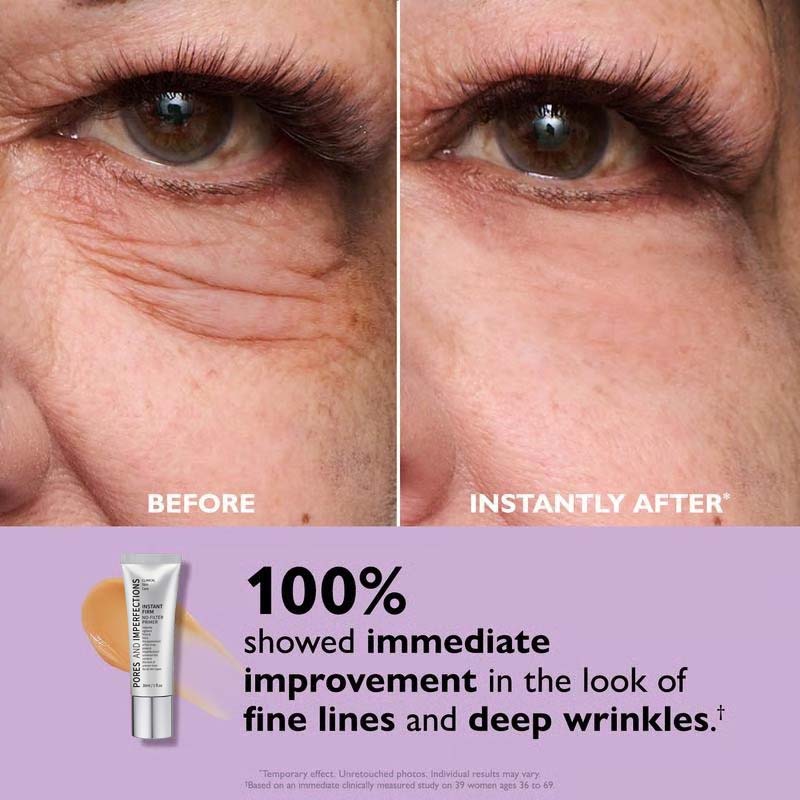 🔥Last Day 49% OFF🎁Temporary Eye Tightener